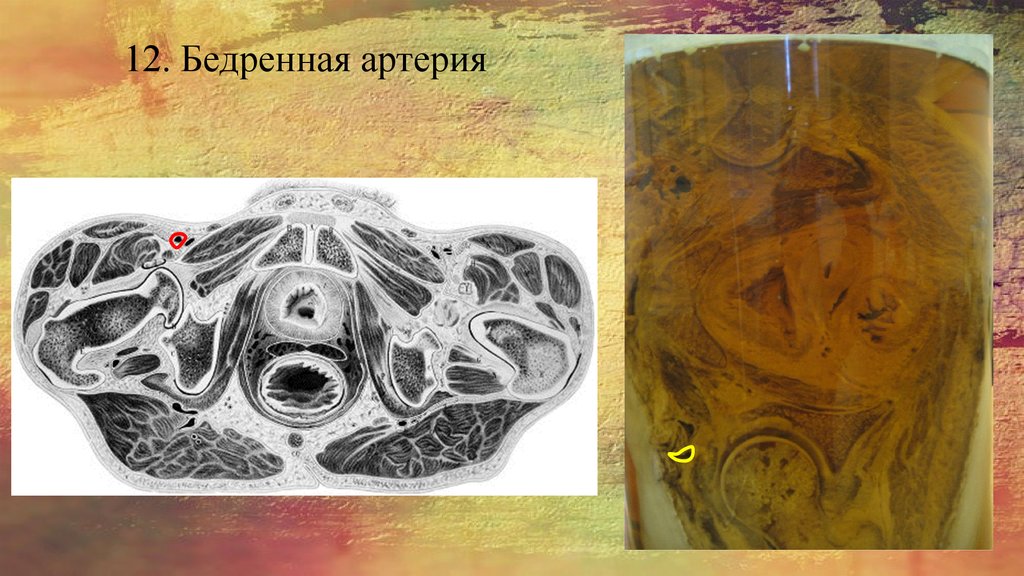 12. Бедренная артерия