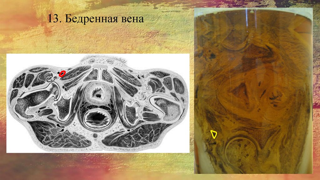 13. Бедренная вена