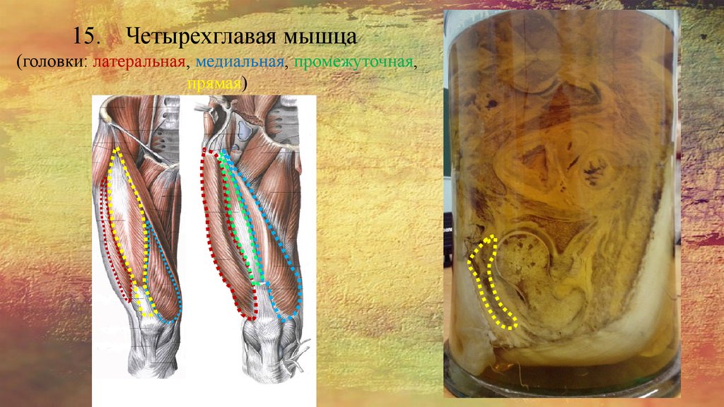 15. Четырехглавая мышца (головки: латеральная, медиальная, промежуточная, прямая)