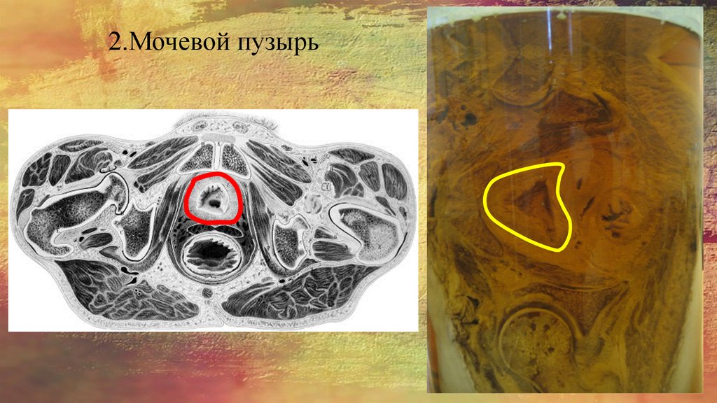 2.Мочевой пузырь