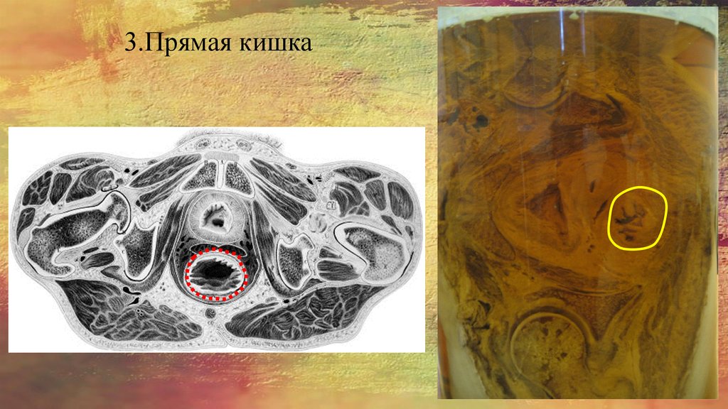 3.Прямая кишка