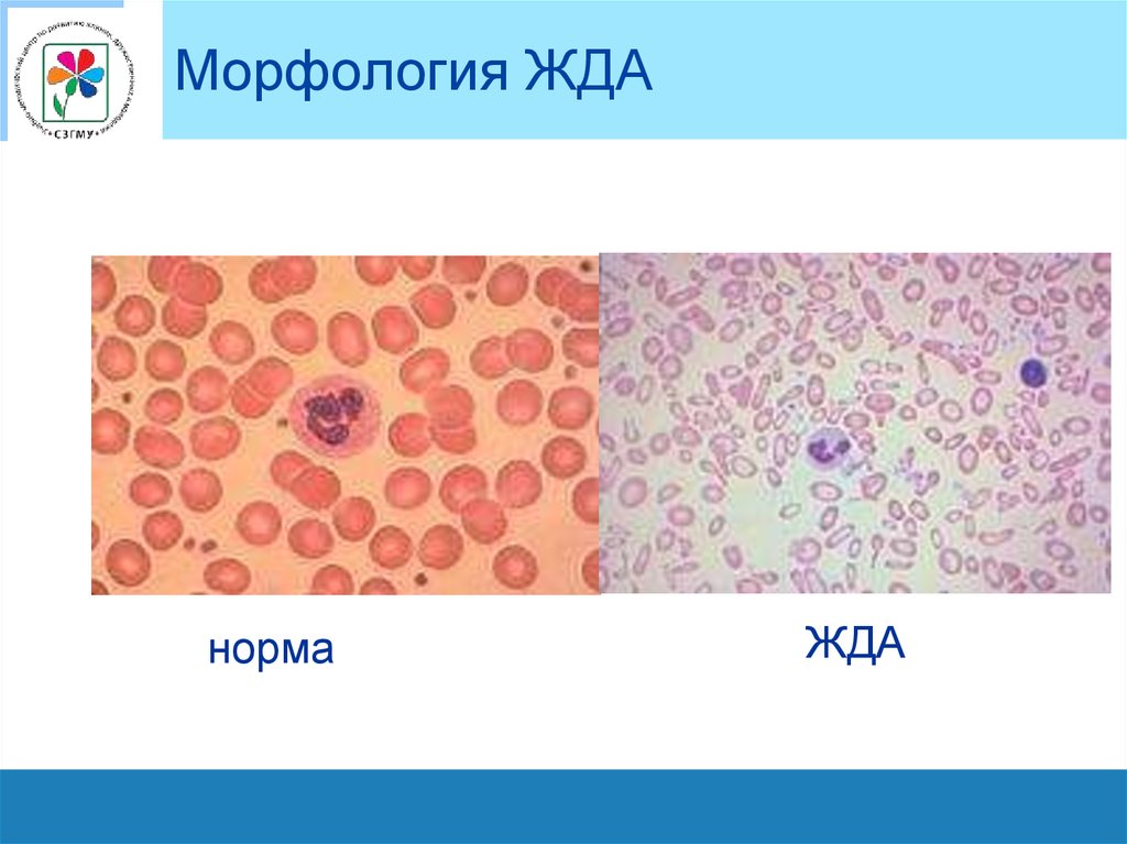 Презентация на тему жда