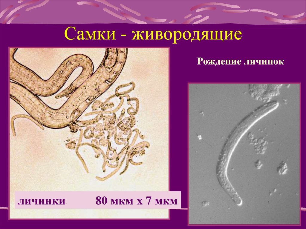 Живородящие круглые черви. Лабораторная диагностика трихинеллеза.