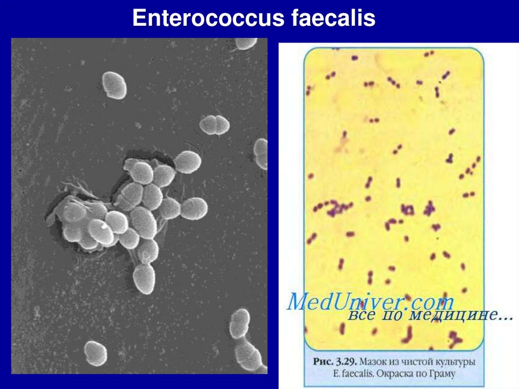 Enterococcus faecalis ohne antibiotika