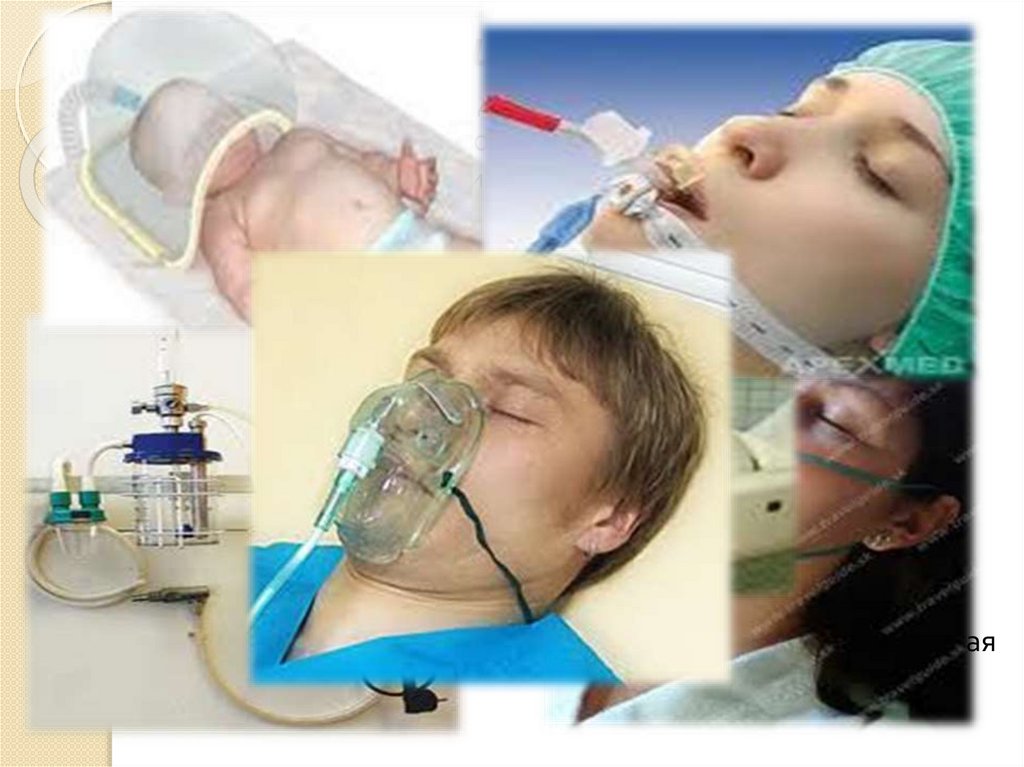 Подача кислорода через маску. Высокопоточная оксигенотерапия. Оксигенотерапия ингаляционный метод. Трахеостома трубка ИВЛ. Трахеостомическая трубка оксигенотерапия.