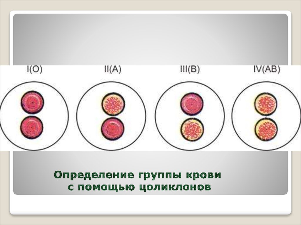 Группа крови волосами. Исследование групп крови человека. 3 Отрицательная группа крови под микроскопом. Определение группы крови. Группа крови Цоликлоны.