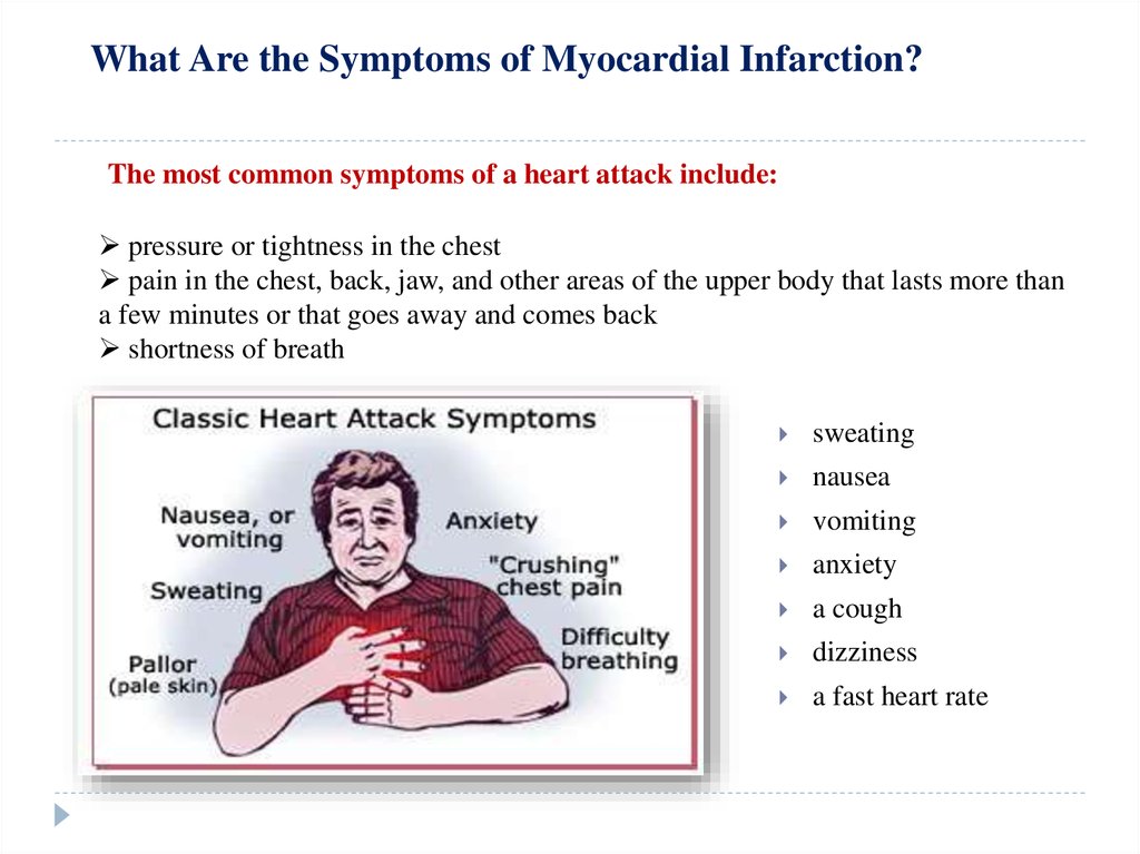 myocardial-infarction