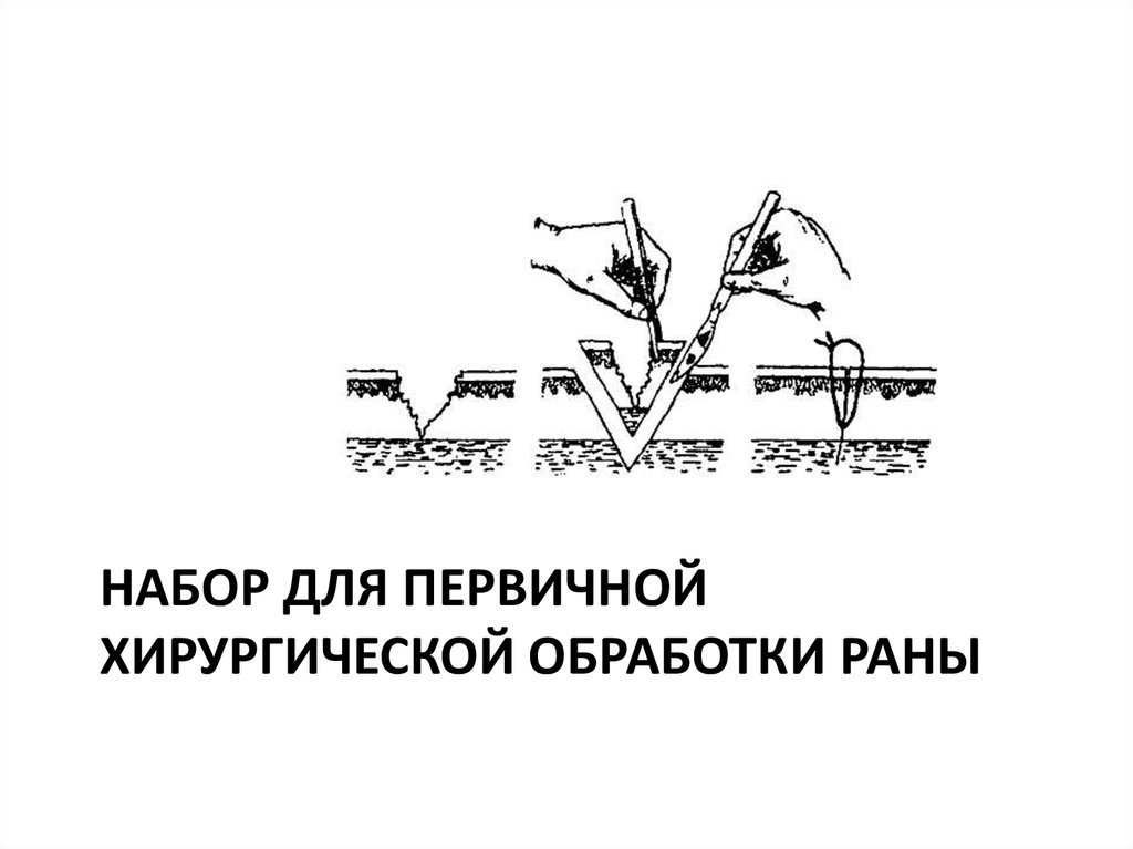 Техника хирургическая первичная обработка раны