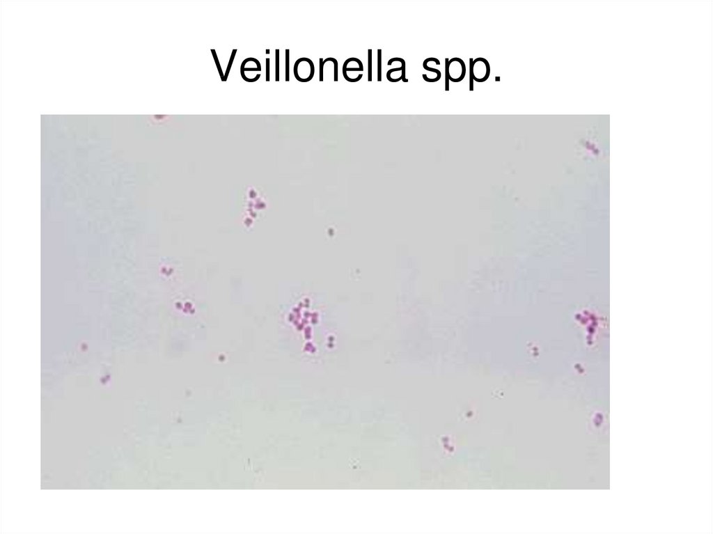 Megasphaera spp veillonella spp dialister spp. Вейлонеллы. Вейлонеллы окраска по Граму. Вейлонеллы морфология. Вейлонеллы микробиология.