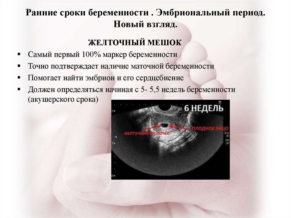 6 недель от зачатия. Акушерский срок и эмбриональный. Срок беременности акушерский и эмбриональный. Акушерский срок и срок по УЗИ. УЗИ по беременности на ранних сроках.