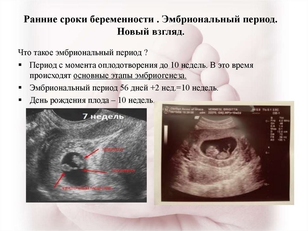 Срок плода 6 недель. Срок беременности акушерский и эмбриональный. УЗИ беременности на ранних сроках. Эмбрион на УЗИ на раннем сроке.