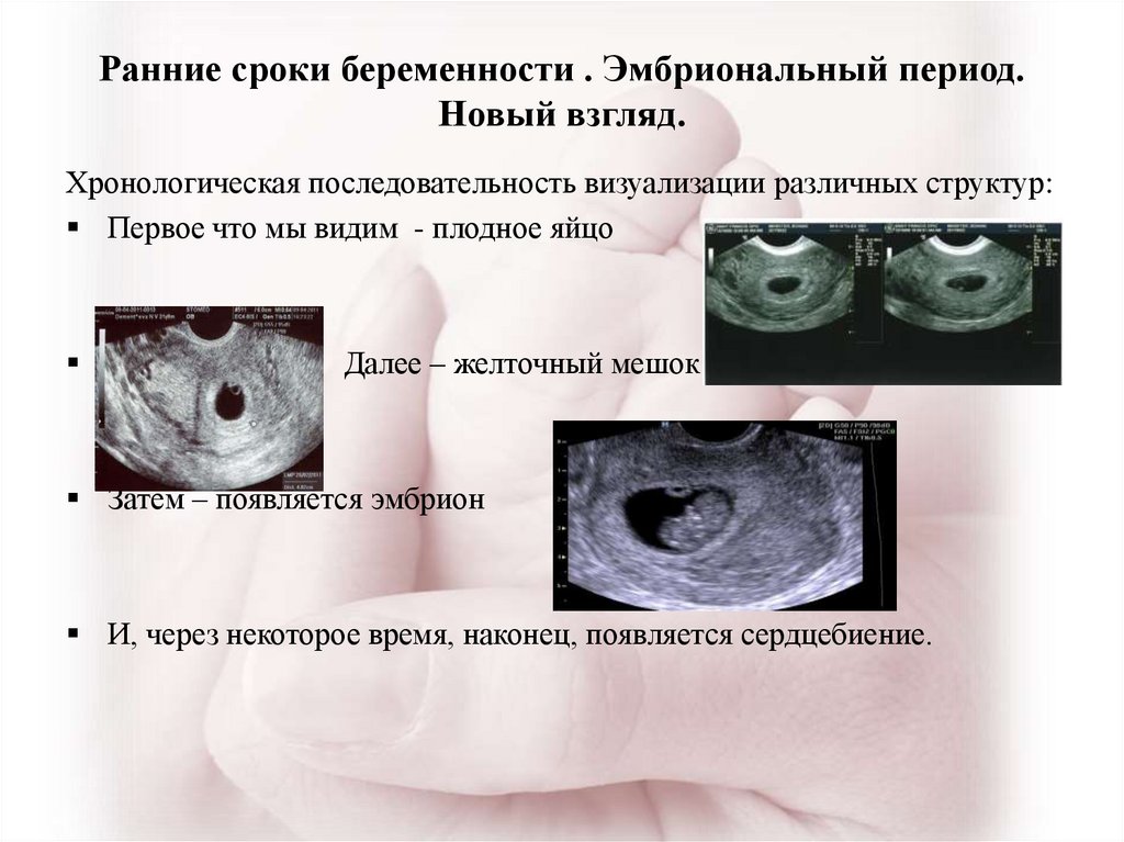 Какие первые ощущения беременности. Беременность на ранних сроках. Признаки беременности малого срока. Беременна ранний срок. Беременность на самых ранних сроках.