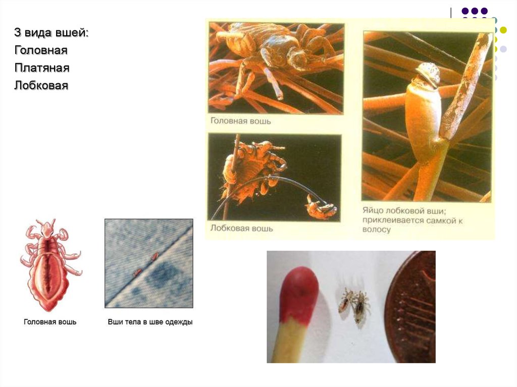 Педикулез чесотка. Платяной педикулез презентация. Виды вшей. Разновидности чесотки.