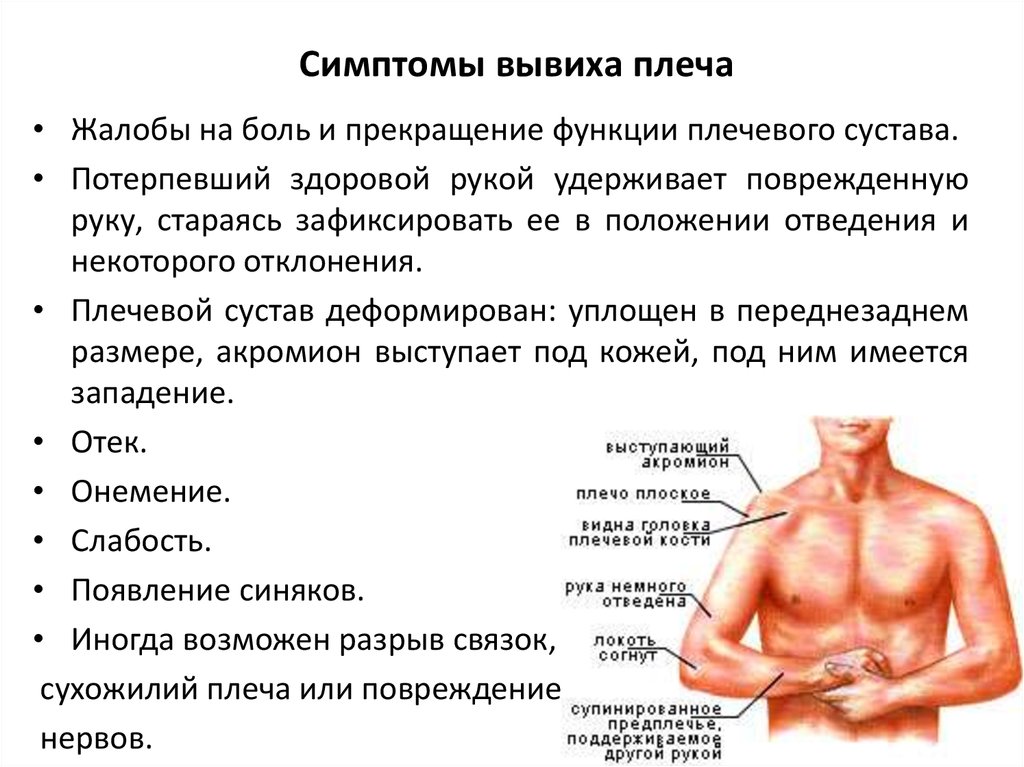 Вывих плеча статус локалис карта вызова