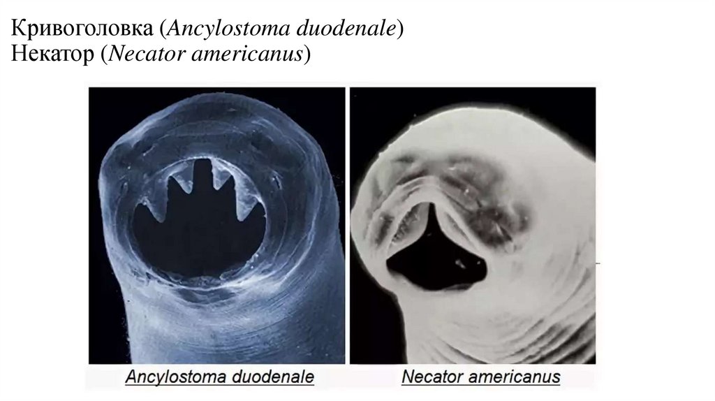 Анкилостома фото как выглядит