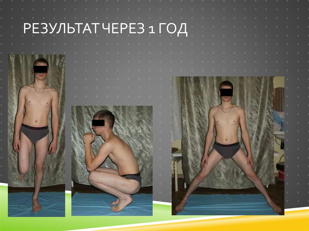 Результат через 1 год