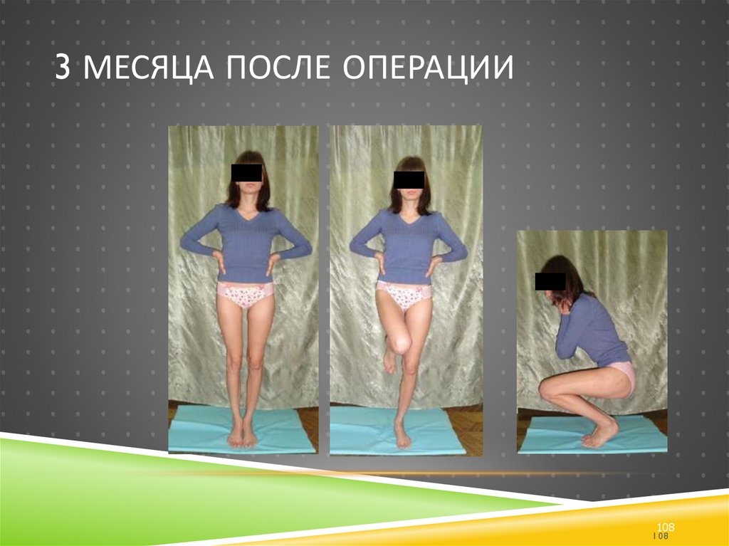 3 месяца после операции