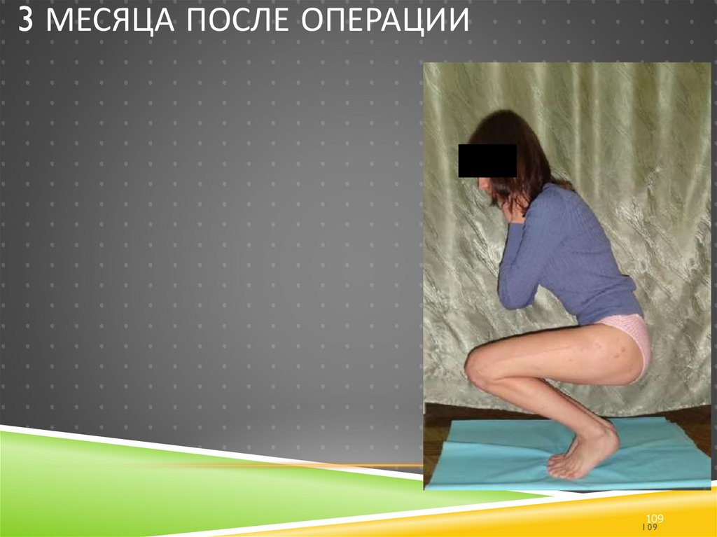 3 месяца после операции