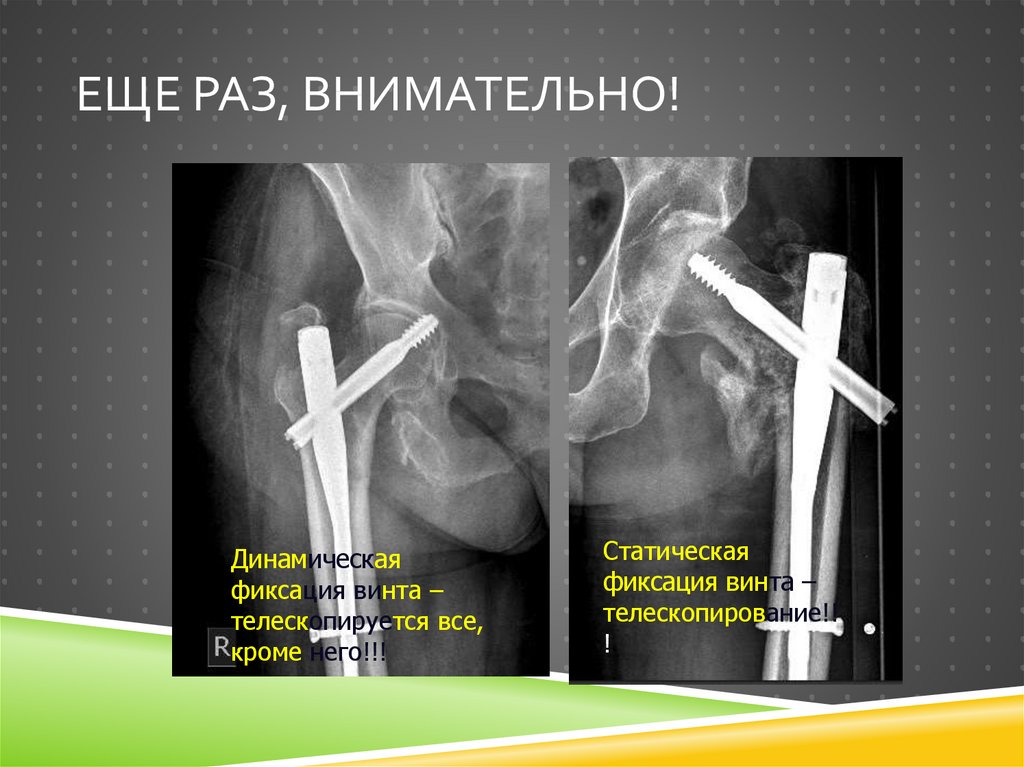 Еще раз, внимательно!