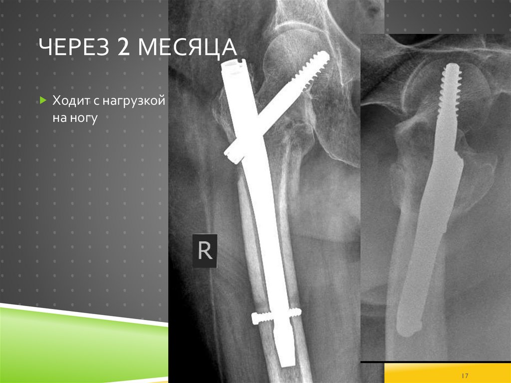 Через 2 месяца