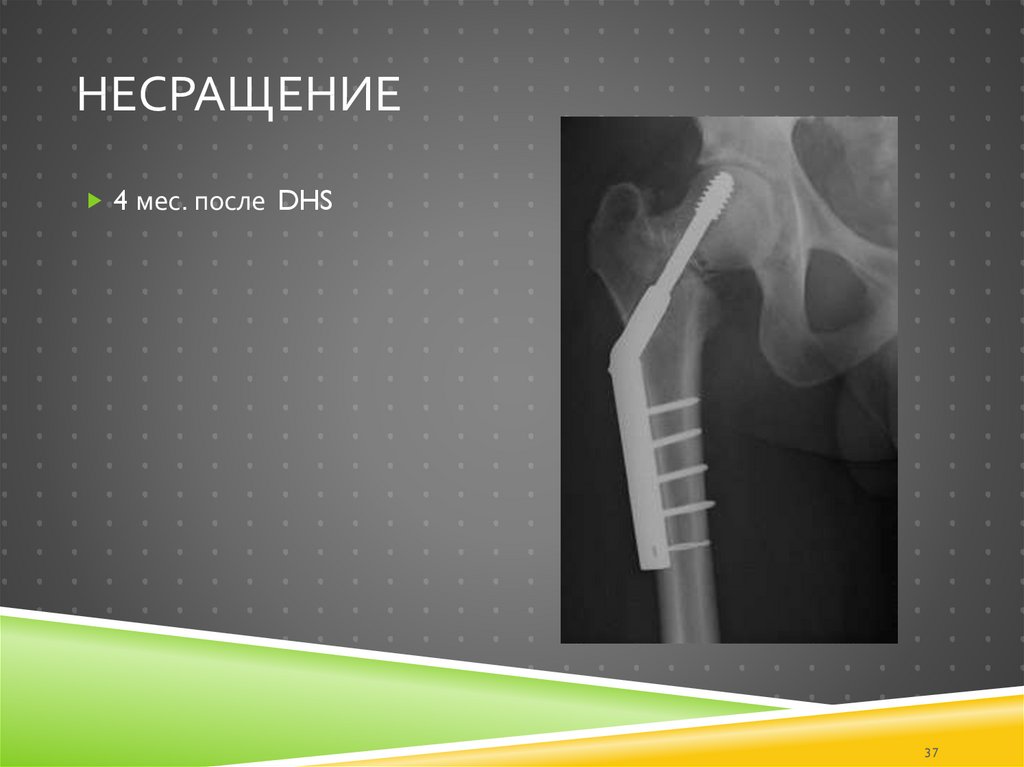 Несращение