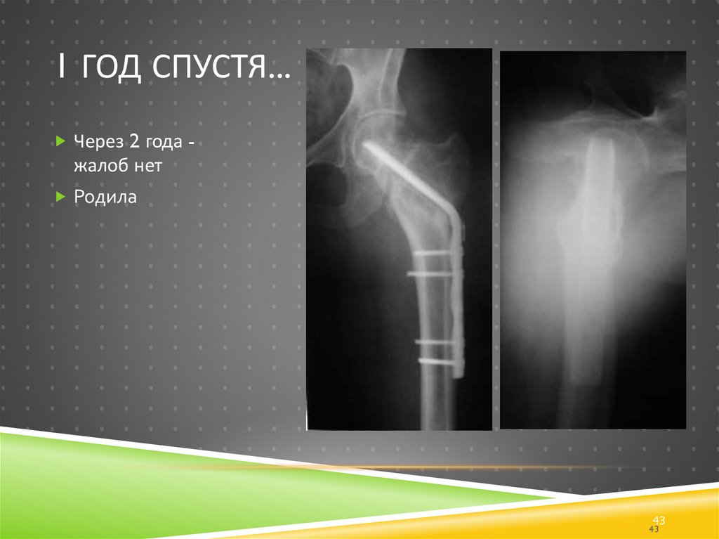 1 год спустя...