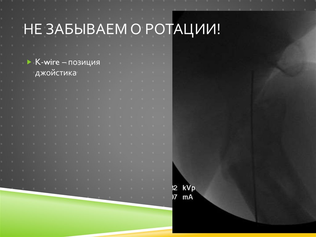 Не забываем о ротации!