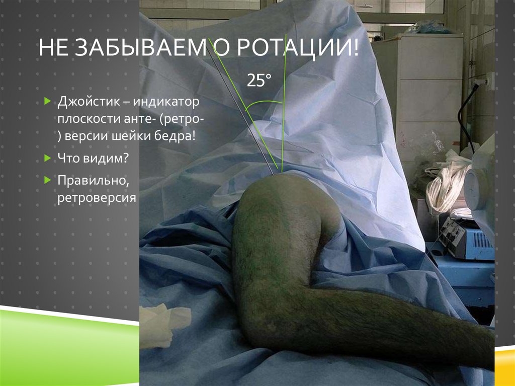 Не забываем о ротации!