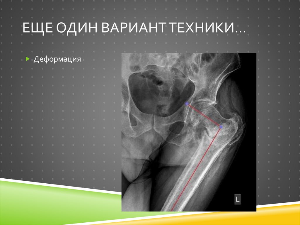 Еще один вариант техники…