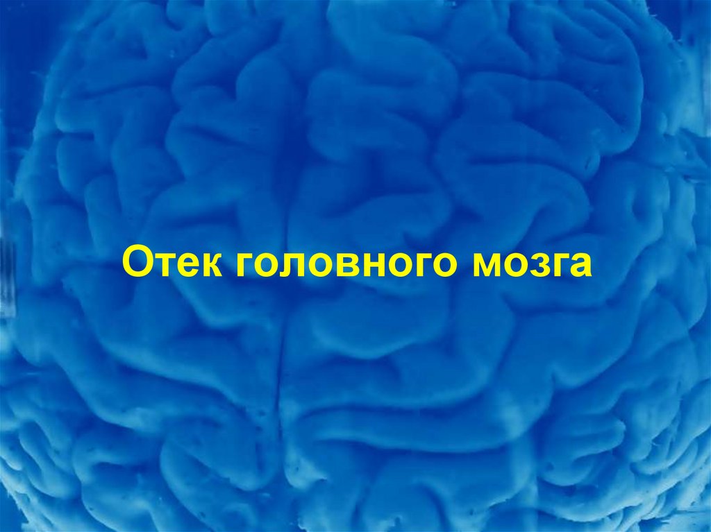 Отек головного мозга