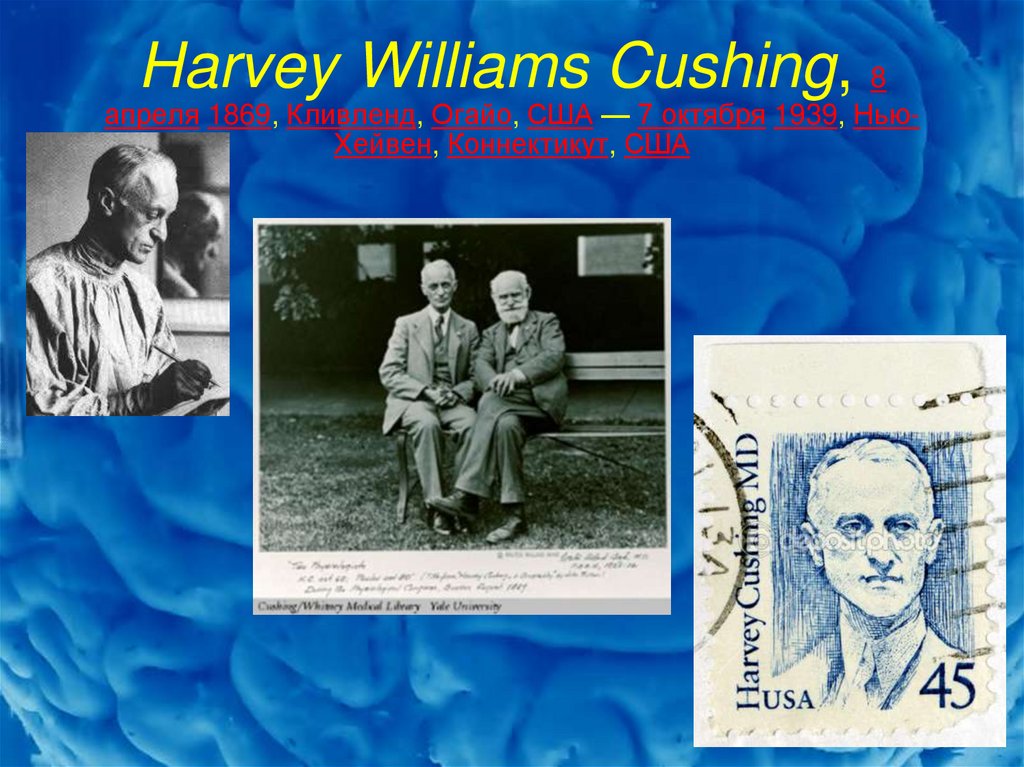 Harvey Williams Cushing, 8 апреля 1869, Кливленд, Огайо, США — 7 октября 1939, Нью-Хейвен, Коннектикут, США