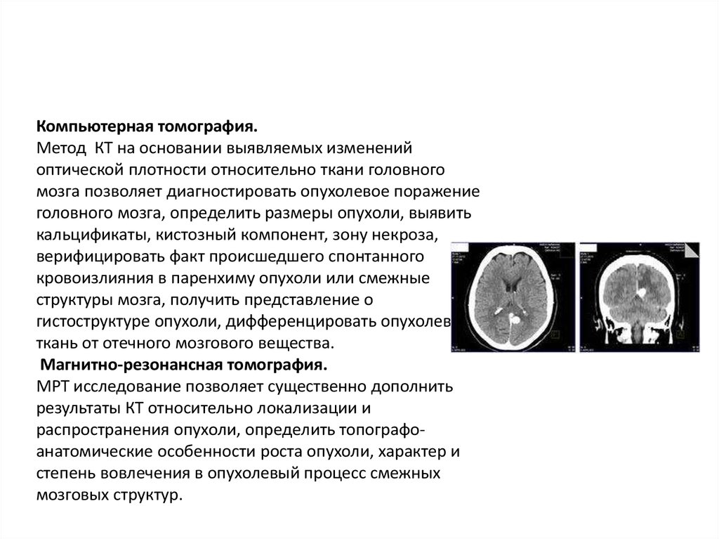 Диффузные изменения головного мозга. Плотность опухоли головного мозга на кт. Плотность вещества головного мозга по кт норма. Плотность крови на кт головного мозга. Кт головы пониженная плотность.