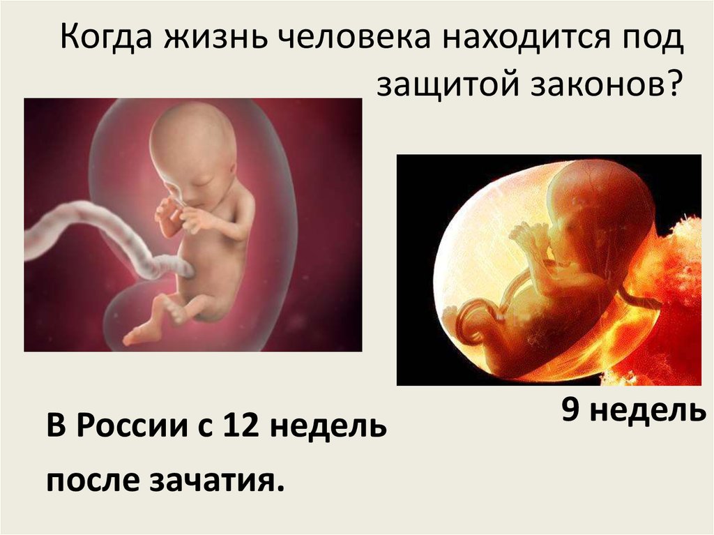 Когда жизнь человека находится под защитой законов?