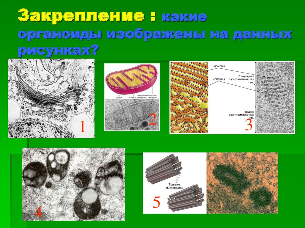 Какой цифрой на рисунке показан органоид содержащий крупные крахмальные зерна