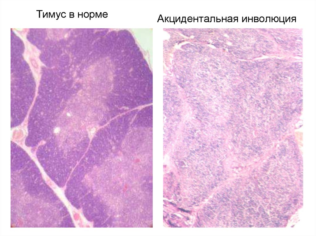 Тимус гематоксилин эозин рисунок