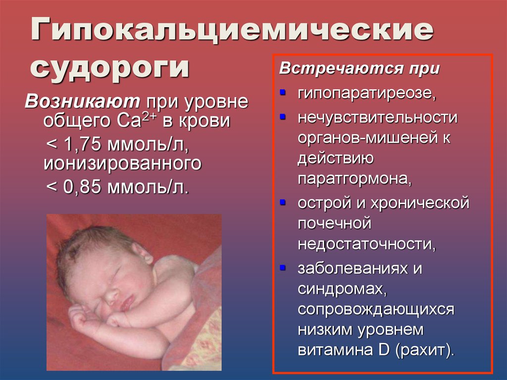 Синдром судорог. Судороги у новорожденных детей. Гипокальциемические судороги. Причины судорожного синдрома у детей. Клинические проявления судорожного синдрома у детей.