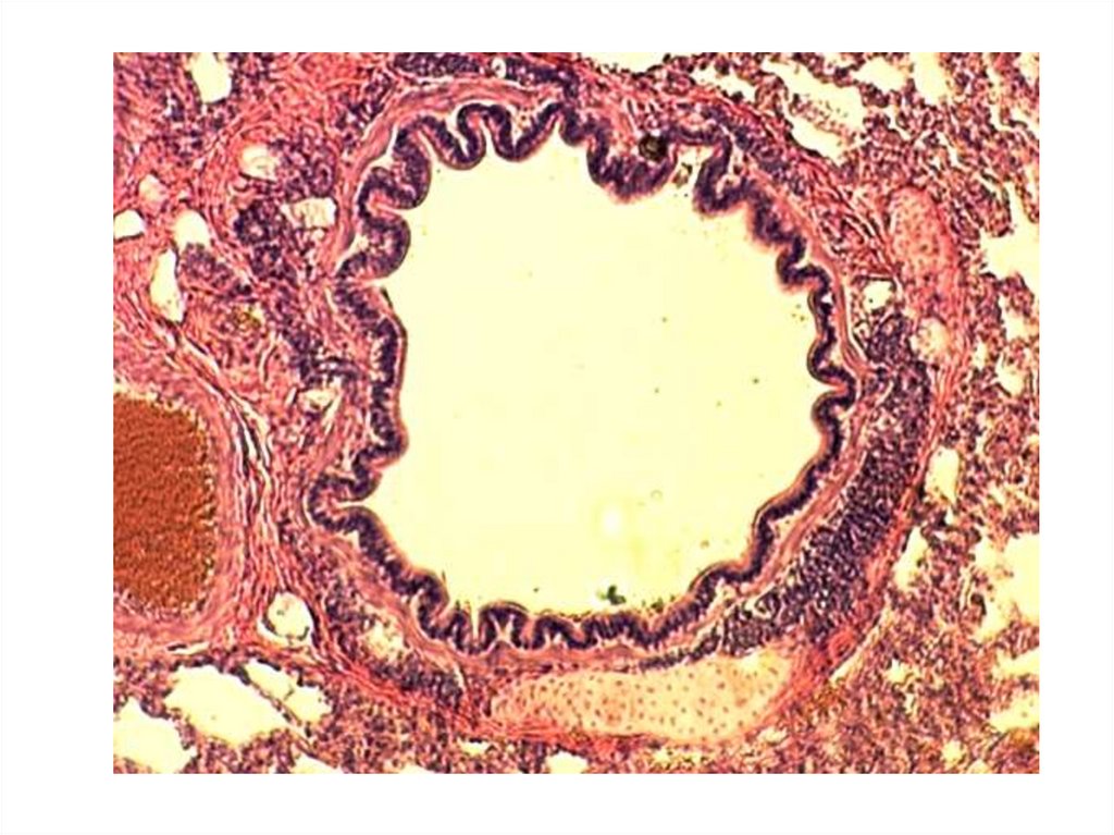 В структуре стенки бронхов малого калибра имеются оболочки