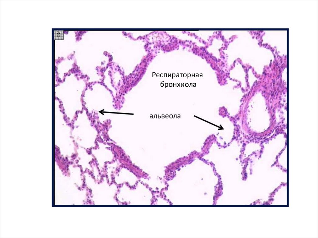 Легкое гистология рисунок
