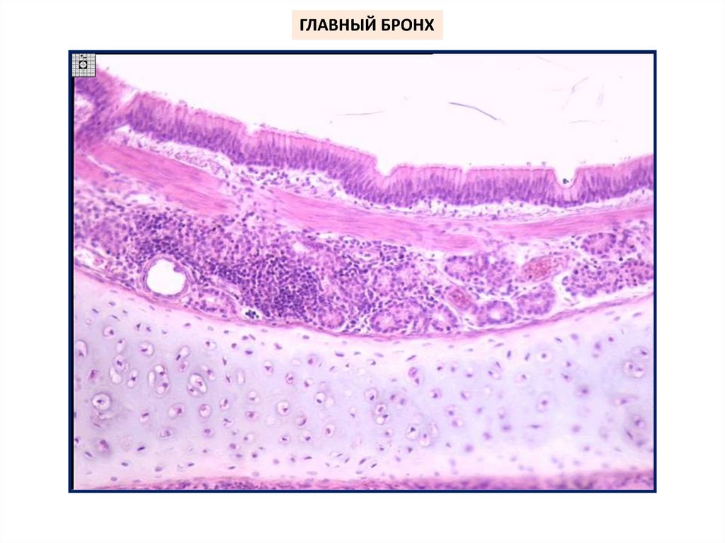 Мелкий бронх эпителий. Препарат бронхов гистология. Крупный бронх гистология препарат. Средний бронх гистология препарат.