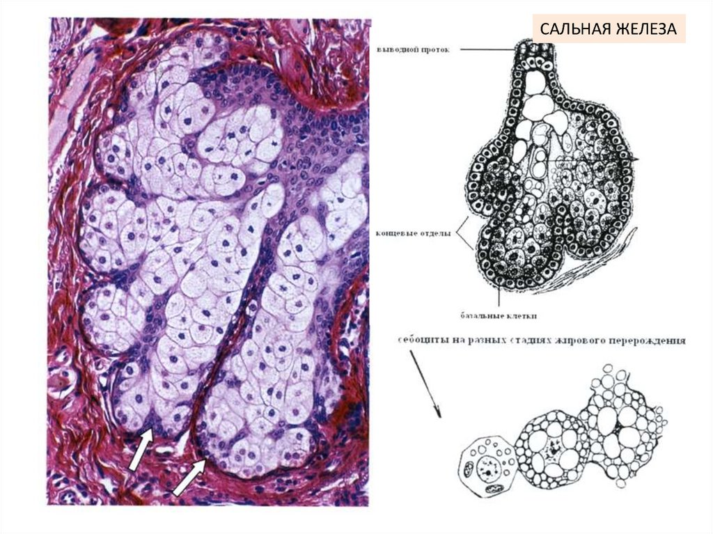 Рисунок сальной железы. Строение сальной железы гистология. Сальная железа гистология. Апокриновые потовые железы гистология. Ацинус сальной железы гистология.