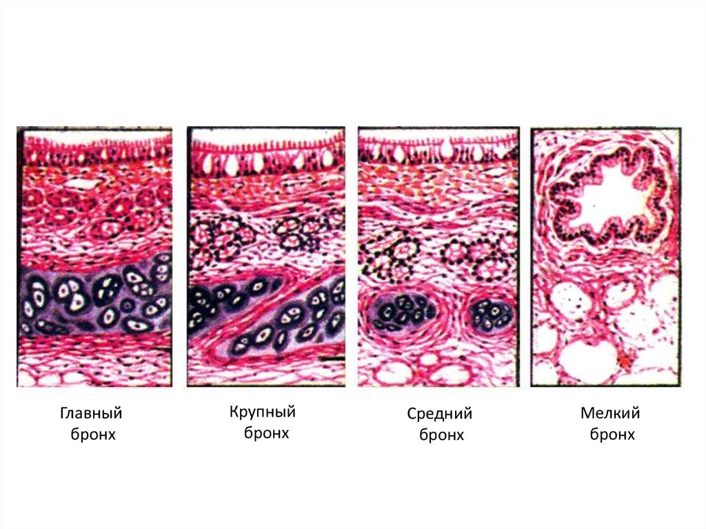 Мелкий бронх эпителий. Гистологическое строение бронхов. Строение стенки бронхов гистология. Стенка бронхов гистология. Крупные бронхи гистология.
