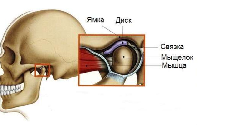 Мыщелки челюсти. Дисфункция височно-нижнечелюстного сустава. Артроз ВНЧС асимметрия.