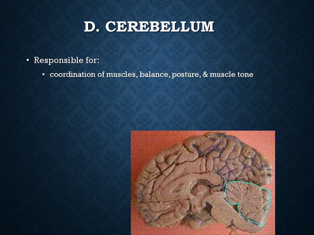 D. Cerebellum