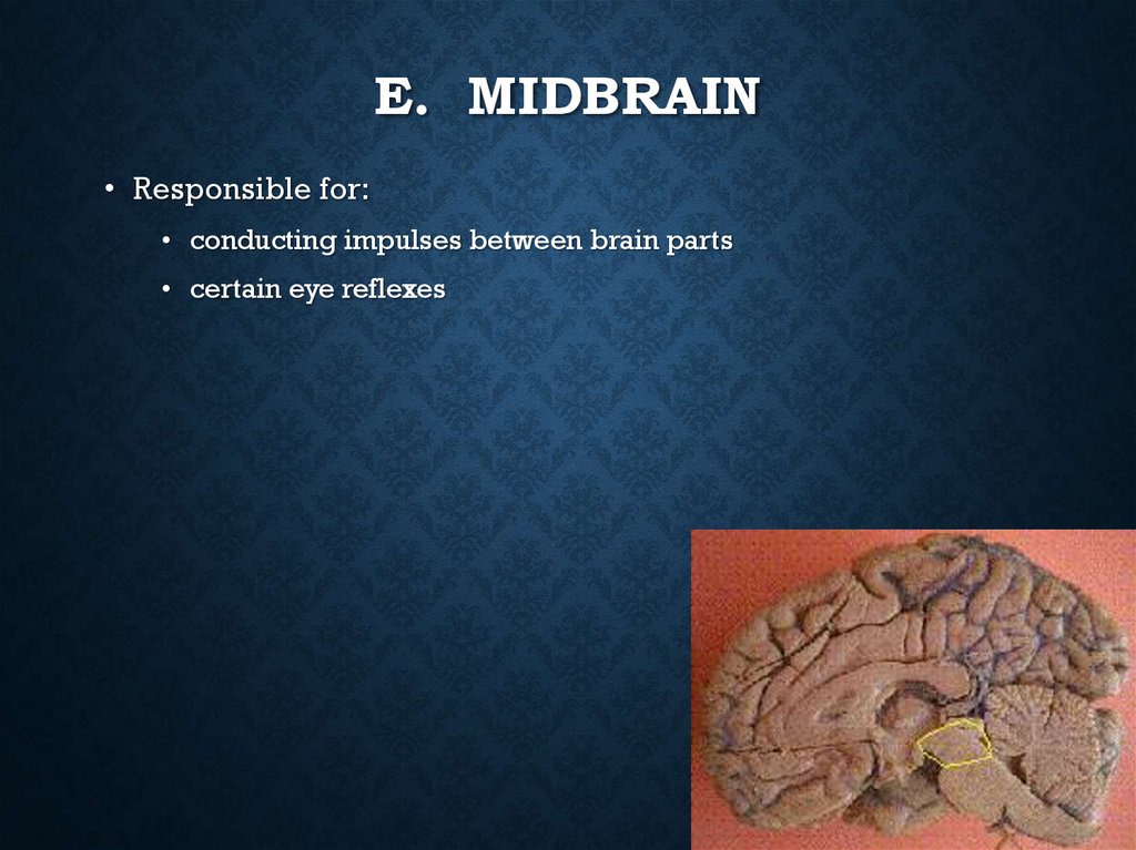E. Midbrain