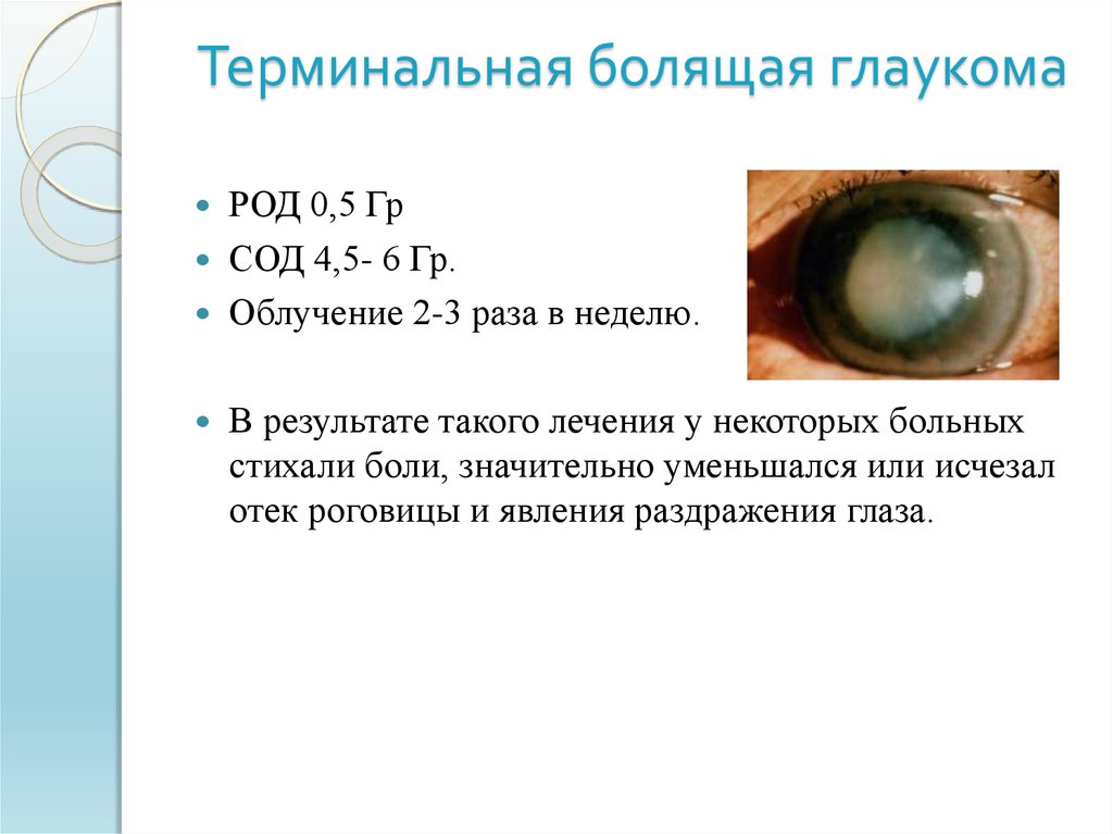 Терминальная болящая глаукома