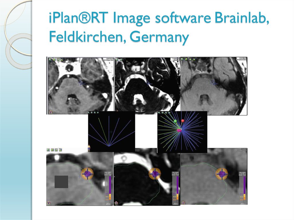 iPlan®RT Image software Brainlab, Feldkirchen, Germany