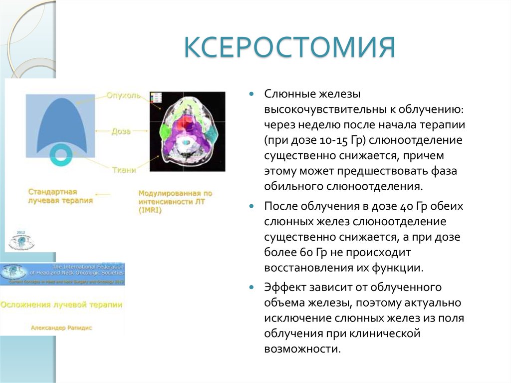 Температура после лучевой