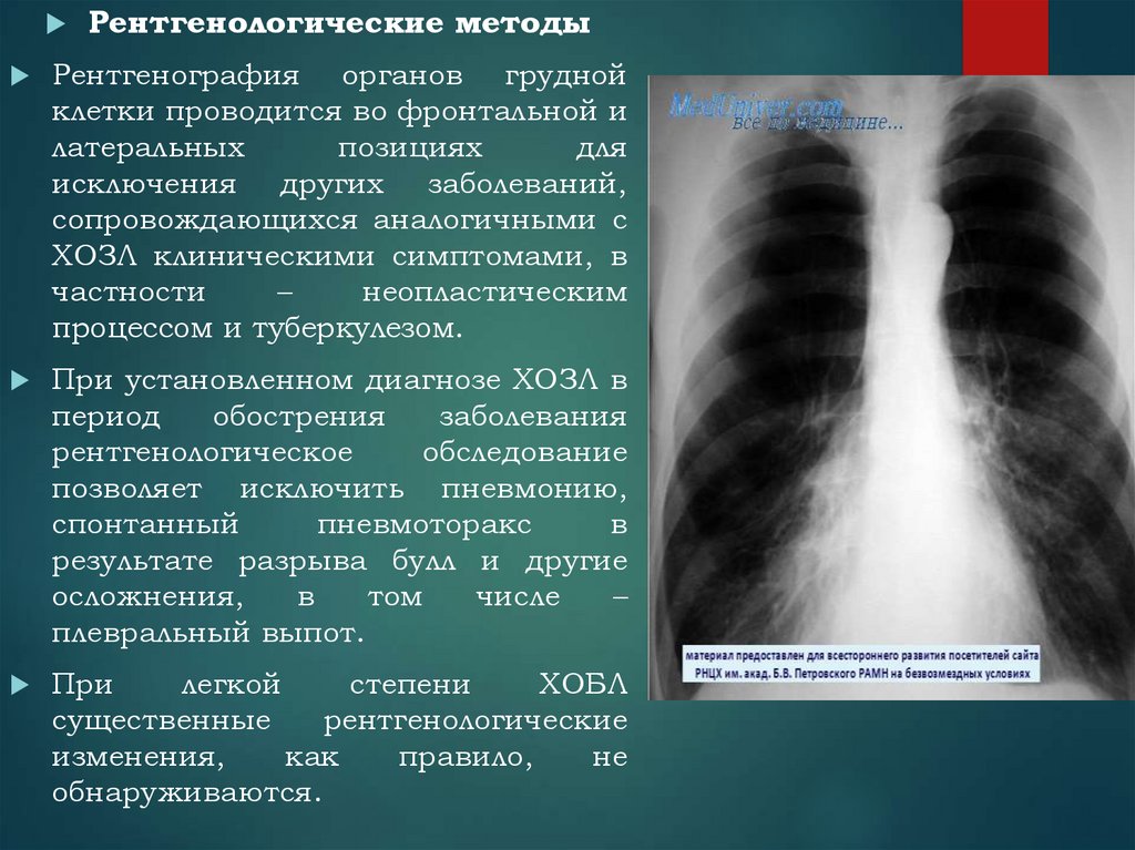 Неопластический процесс в легких. Рентгеноскопия органов грудной клетки. Неопластического характера что это. Методы и методики исследования органов грудной клетки. Методы рентгенографии.