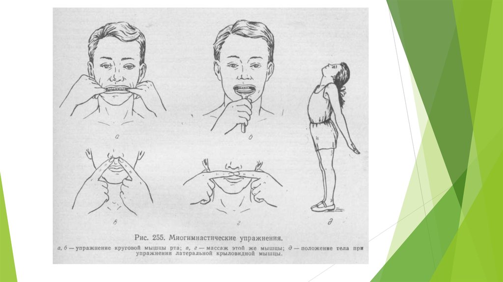 Презентация миогимнастика в ортодонтии - 85 фото
