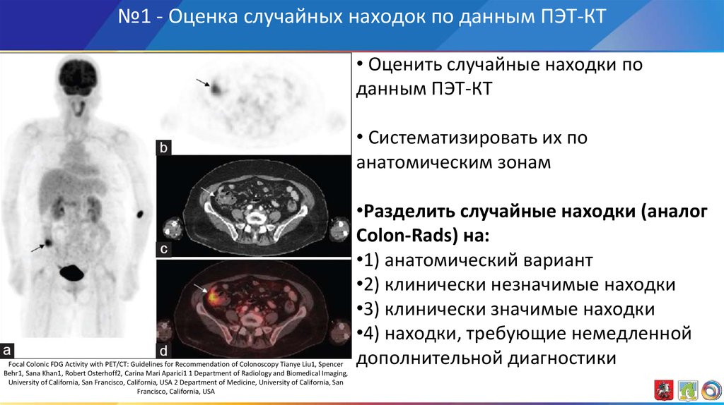 Как расшифровать пэт кт